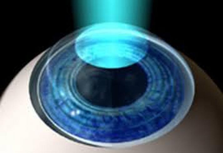 خداحافظی با عینک